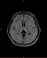 MRI��]�t���A�[�摜