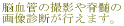 �É������}�s�@���ȁE�]�_�o�O�ȁE���n�r���e�[�V�����ȁ@�g�c�N���j�b�N�ł͔]���ǂ̎B�e��Ґ���
�摜�f�f���s���܂��B